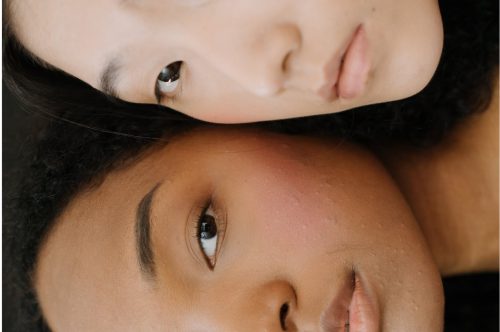 The 10 Best Organic Acne Treatments